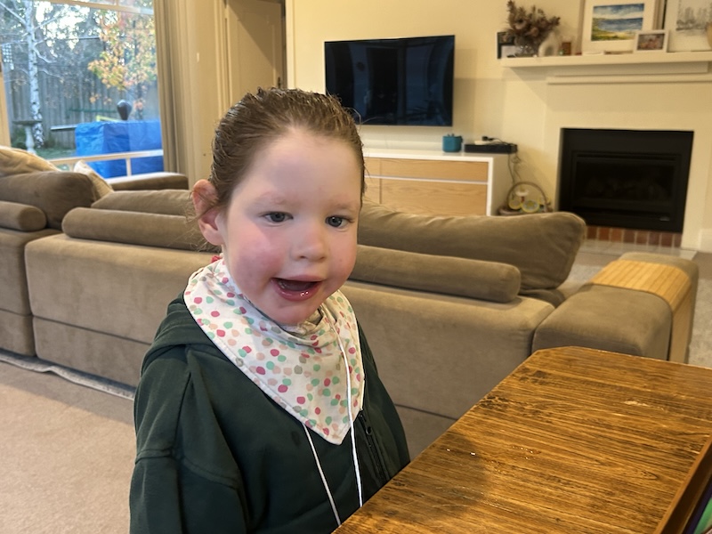 Annabelle has ReNU syndrome, a rare genetic disorder